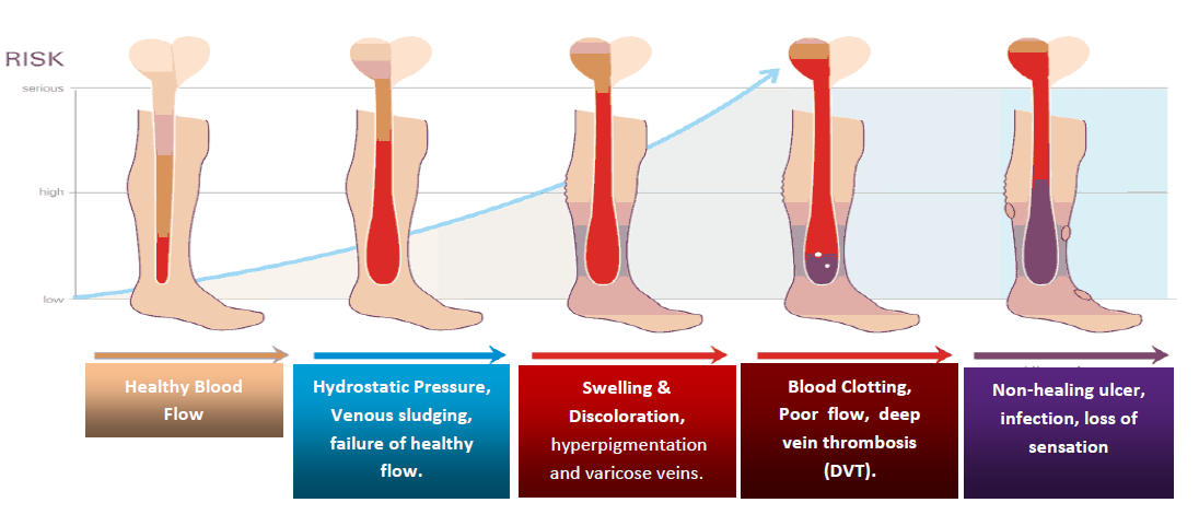 Scientific rationale and the importance of vascular blood flow